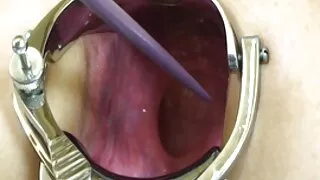 Mát-xa tóc vàng trong miệng hoạt nhật nguoi dit heo cai Bản